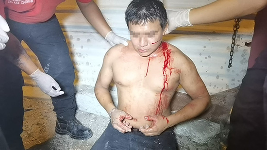 Caguamazo en la cabeza